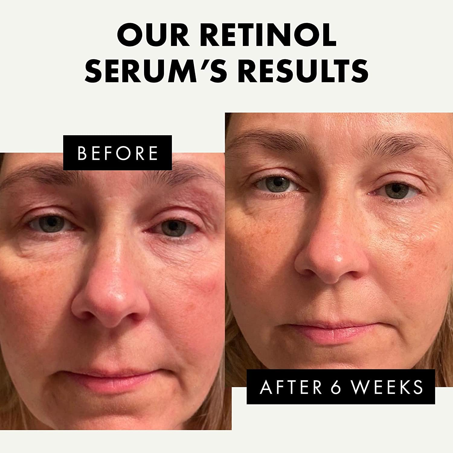 Retinol Serum for Face Hydrating Hyaluronic Acid for Wrinkle Soothing Fine Lines Dark Spots Renew Reset Nighttime Serum