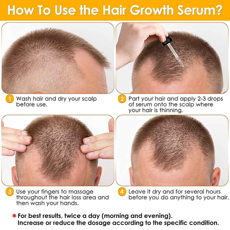 Biotion Hair Growth Serum